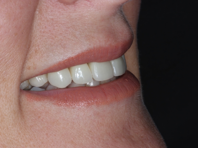 Estética Dental y Diseño de la Sonrisa 