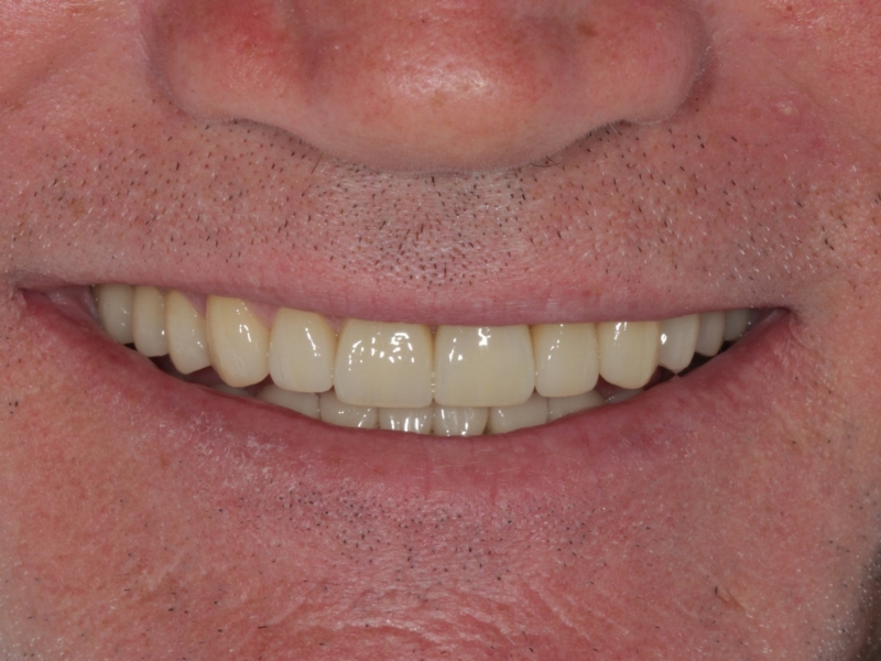 Rehabilitación Oral 