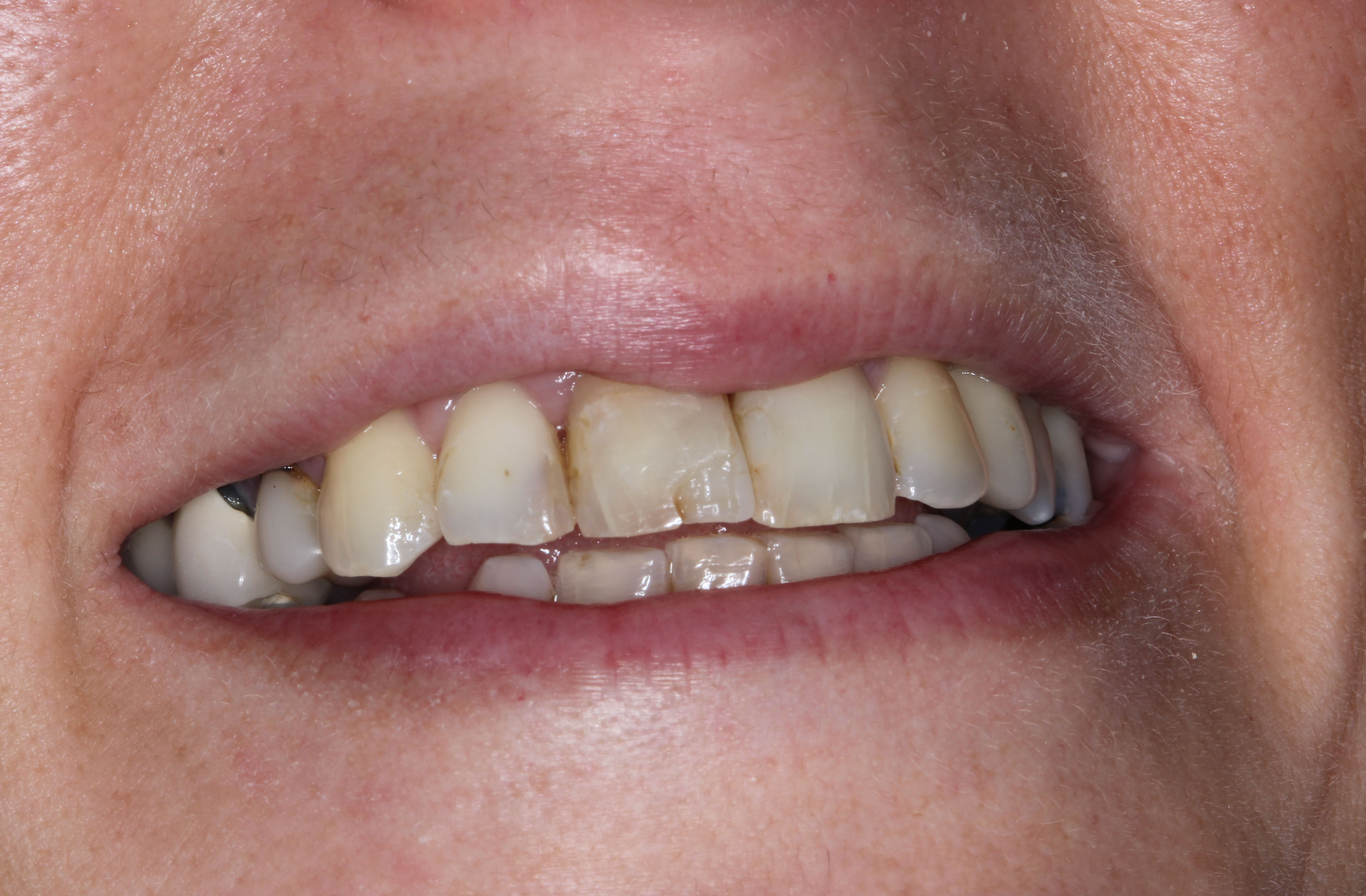 Estética Dental y Diseño de la Sonrisa 