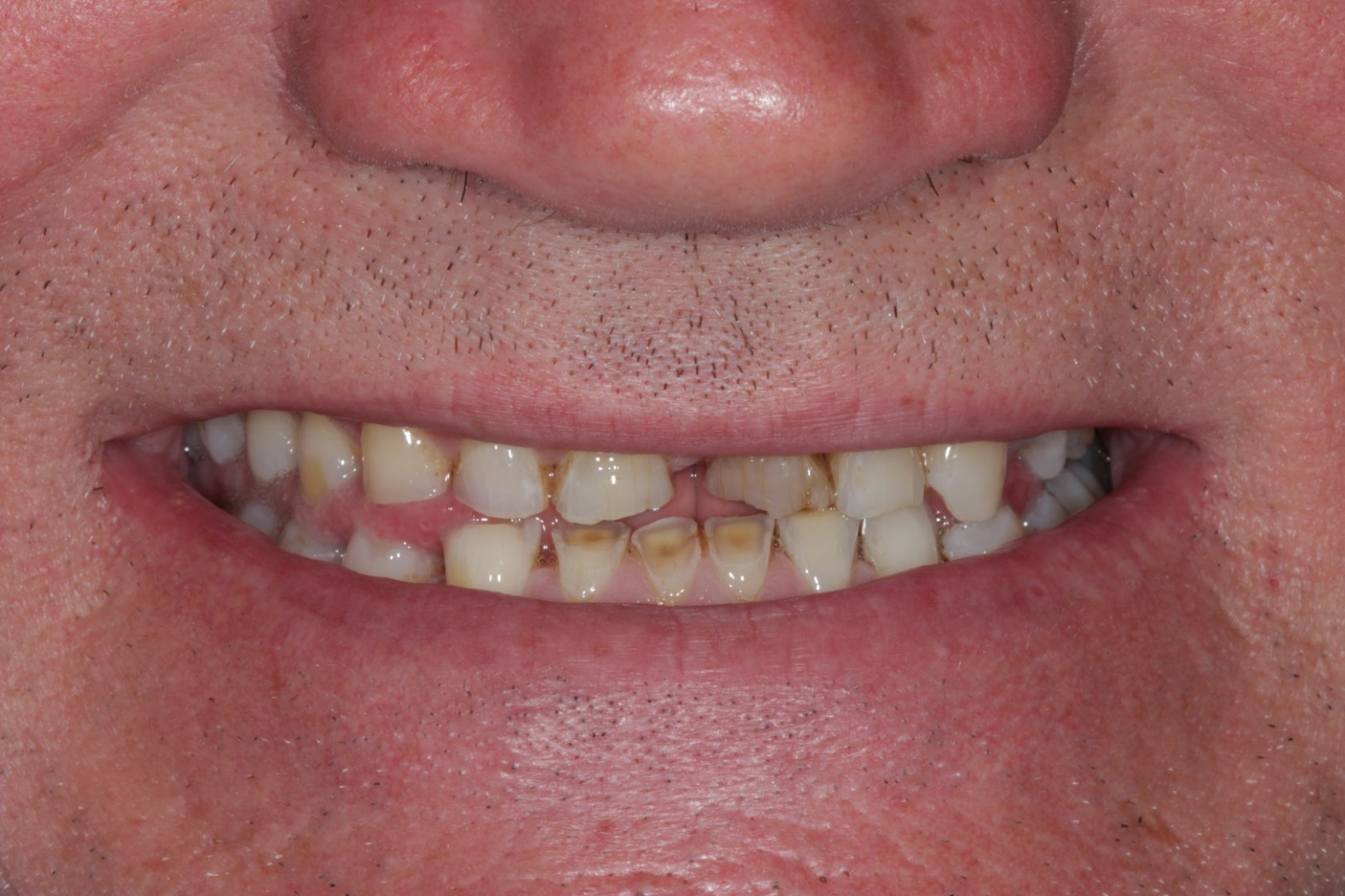Rehabilitación Oral 
